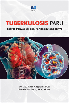 Sampul buku Tuberkulosis paru ti...